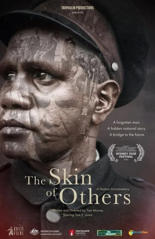 The Skin of Others